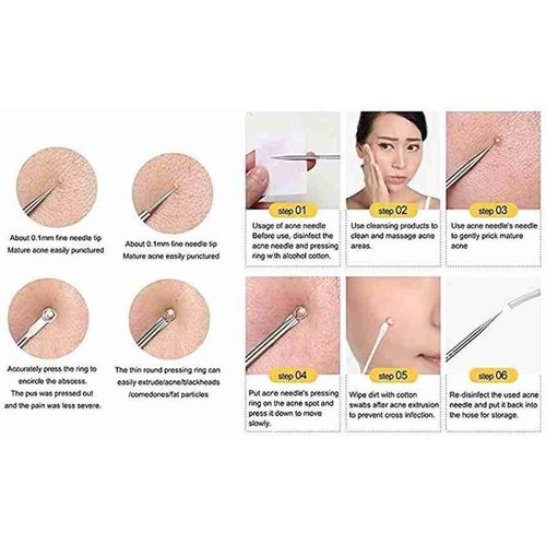 Pimples Away Blackhead Remover.