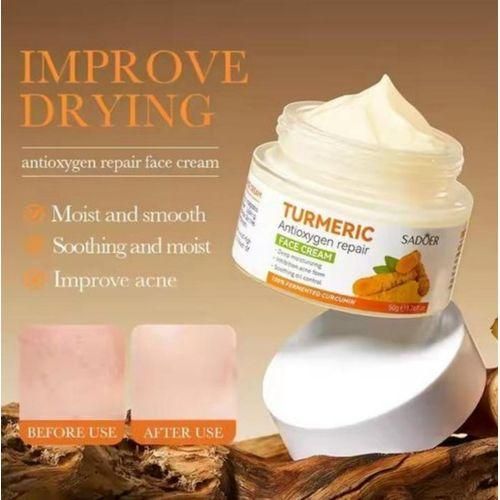 Cream SADOER Turmeric Cream, Anti Acnes, Oil Control Tumeric Face Controls Oil, Moisturize, Smoothening, Fade Dark marks, Acne TreatmentCream