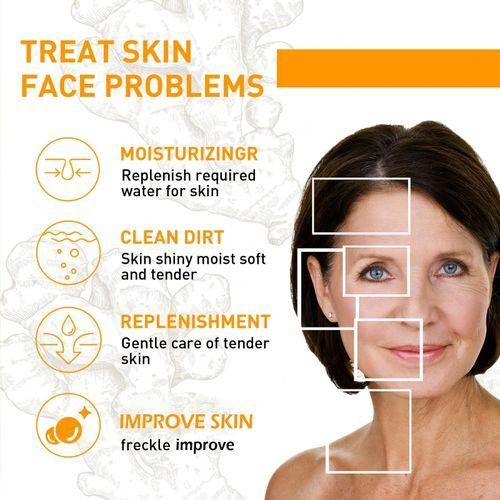 Cream SADOER Turmeric Cream, Anti Acnes, Oil Control Tumeric Face Controls Oil, Moisturize, Smoothening, Fade Dark marks, Acne TreatmentCream