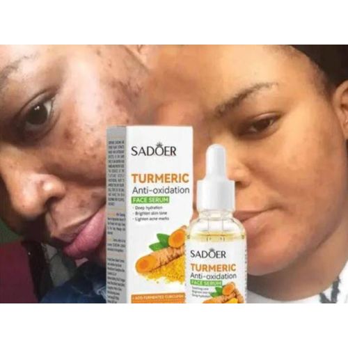 Br Serum Sadoer Turmeric Anti-Oxidation Deep  Hydrating Face Serum-Brighten Skin  Tone&Lighten Acne Marks-30ml