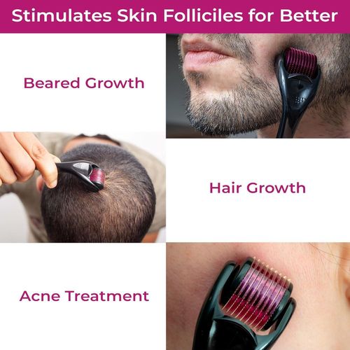 Derma Roller Micro Needle Roller for Internal Skin Regeneration, Anti-Ageing Treatment, Anti-Wrinkle, Cellulite, Scars, Stretch Marks, Stainless Steel, 540 Needles (0.5mm)