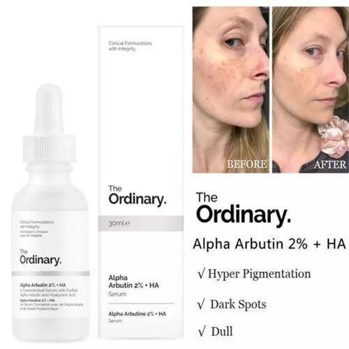 The Ordinary Alpha Arbutin 2% +HA Fading Acne Marks Serum(30ml)