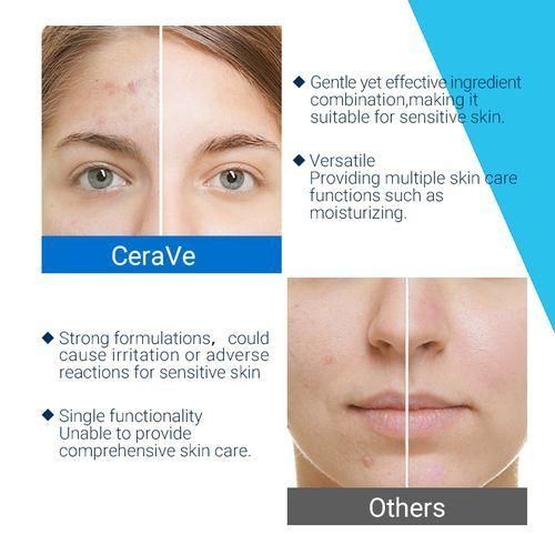 Cerave SA Smoothing Cleanser Acne Prone Oily Skin Washing Agent Anti-acne Facial Cleanser